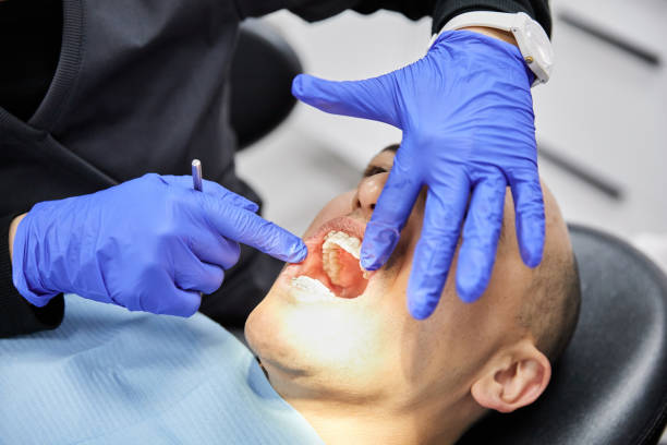 Best Emergency Root Canal Treatment in Burnet, TX